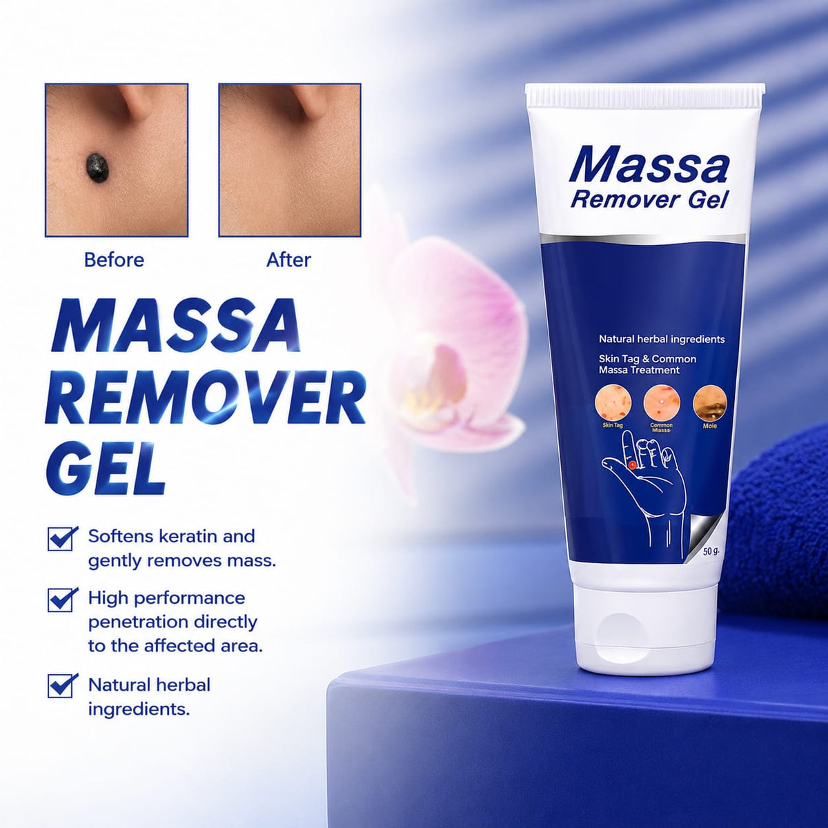 Celvin Warts Remover Cream – BUY 1 GET 1  | Convenient Skin Care Solution