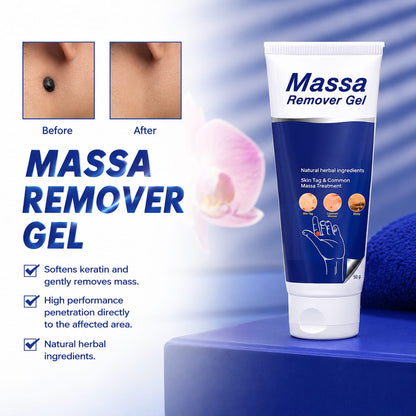 Celvin Warts Remover Cream – BUY 1 GET 1  | Convenient Skin Care Solution