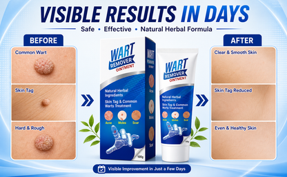 Celvin Warts Remover Cream – BUY 1 GET 1  | Convenient Skin Care Solution