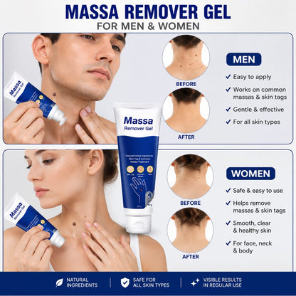 Celvin Warts Remover Cream – BUY 1 GET 1  | Convenient Skin Care Solution